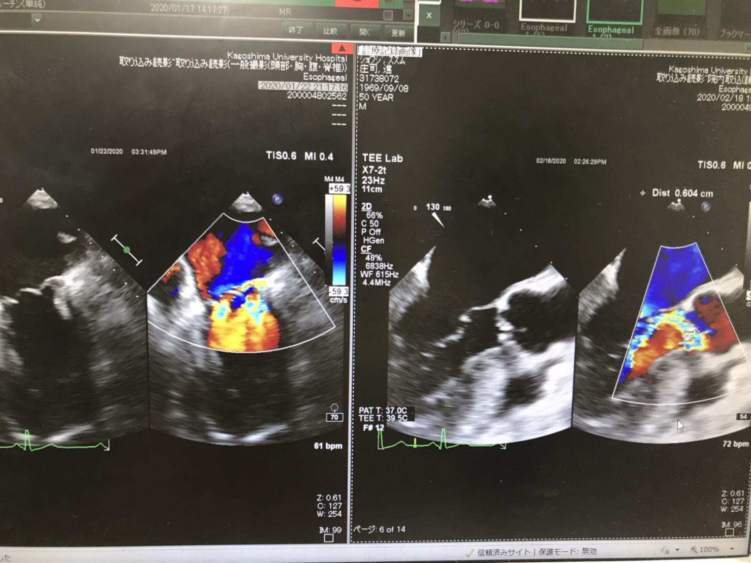 心エコーのお写真
