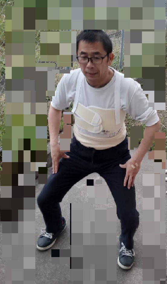 術後4カ月目のお写真